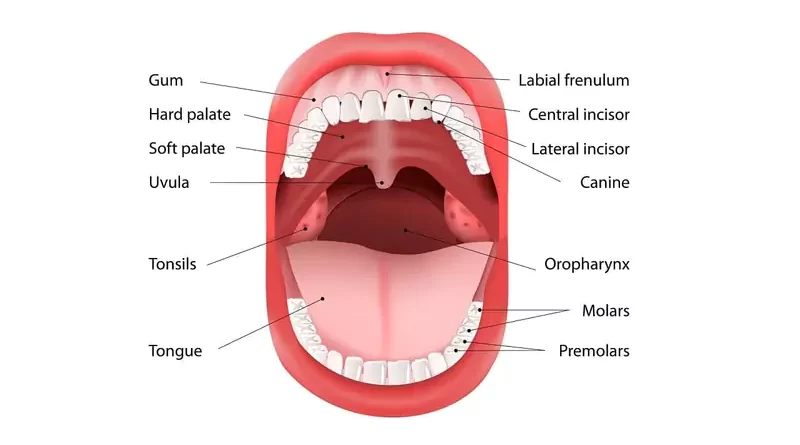 Hard Palate Cancer