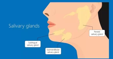 Submandibular Gland Cancer