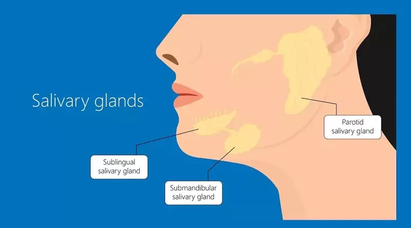 Submandibular Gland Cancer